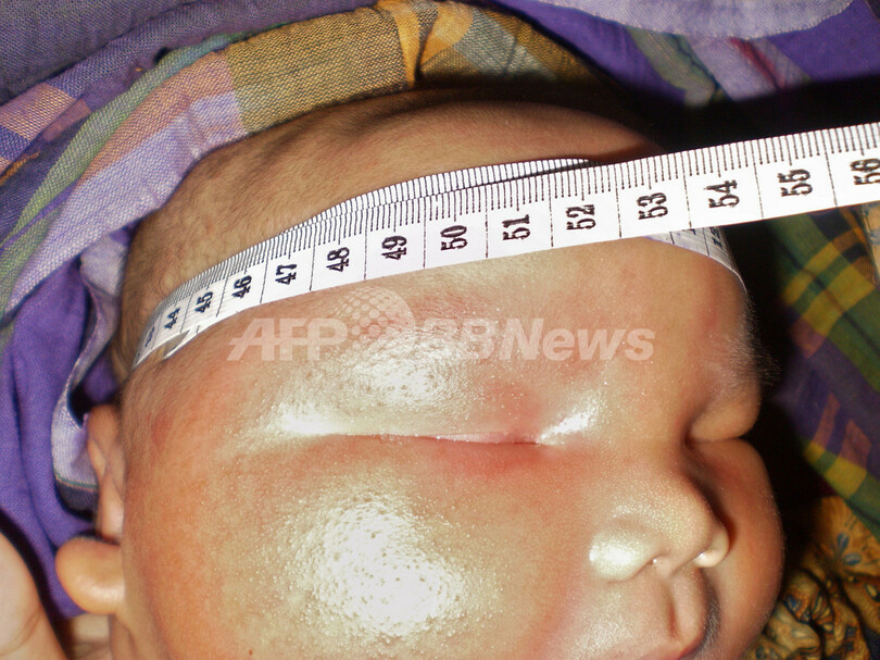 体重8.7キロの新生児が誕生、インドネシア