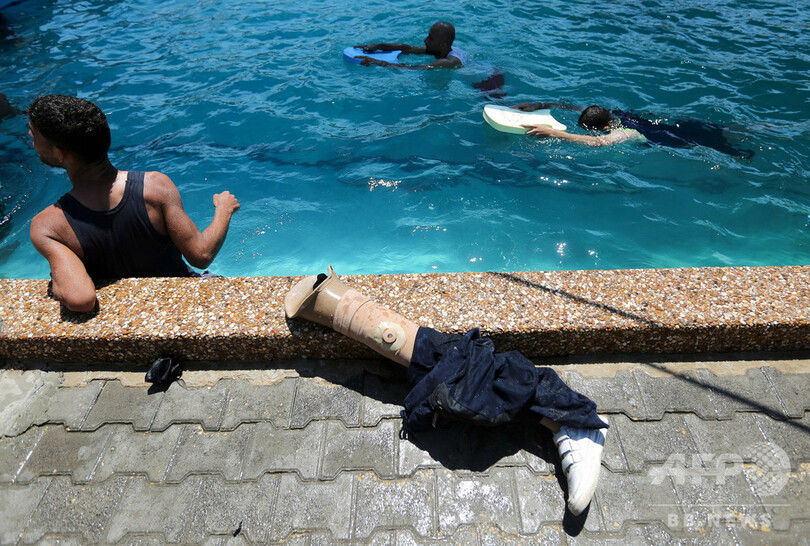 【今日の1枚】義足を外してトレーニング