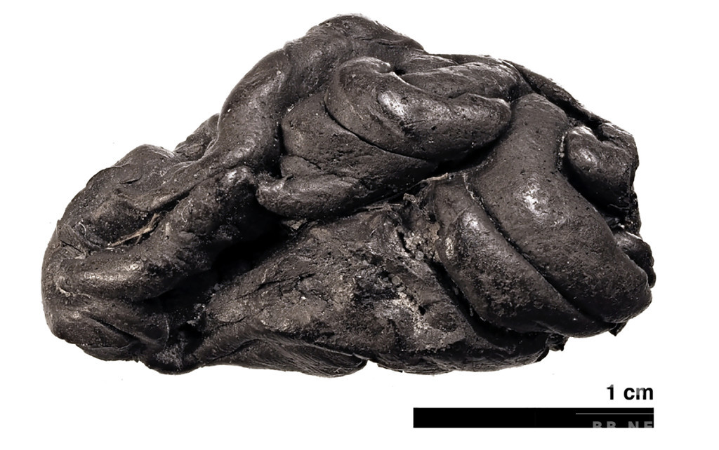 石器時代のチューインガム? 「やにの塊」からヒトDNA抽出 石器時代のチューインガム? 「やにの塊」からヒトDNA抽出