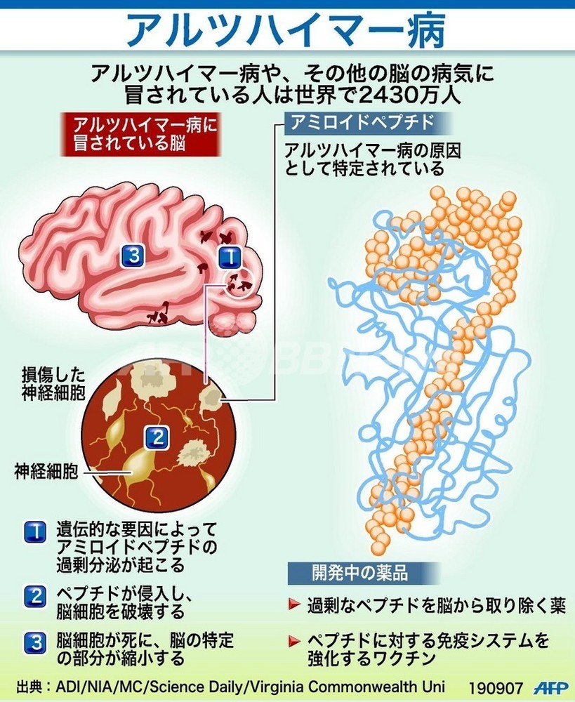 アルツハイマー病の原因