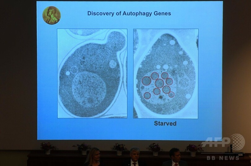 細胞の廃棄物処理機構「オートファジー」、健康増進のカギ握る可能性