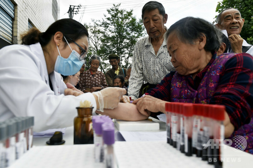 中国の平均寿命77.3歳に上昇、背景に医療衛生資源の増加