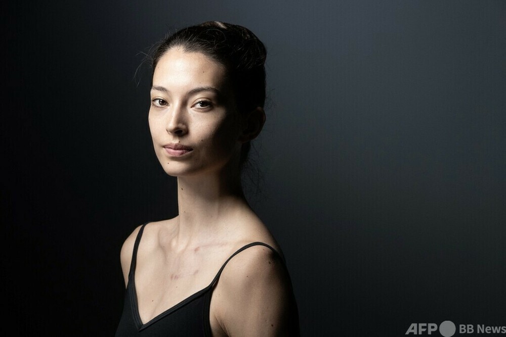 仏パリ・オペラ座、エトワールにオニール八菜さんら任命 写真5枚 国際ニュース:AFPBB News