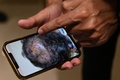 インドの首都ニューデリーの診療所で、植毛手術を受けた患者の写真を見せるマヤンク・シン医師（2022年11月5日撮影）。(c)Sajjad HUSSAIN / AFP