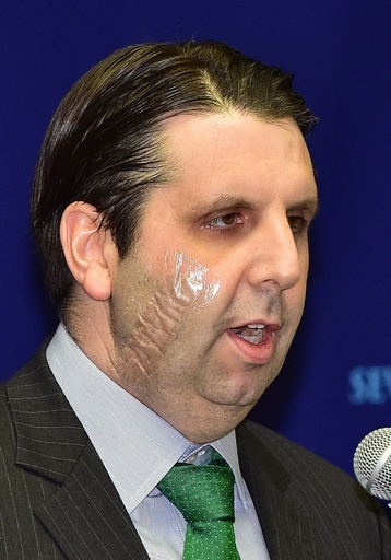 刃物男に襲われた駐韓米大使が退院、ソウル