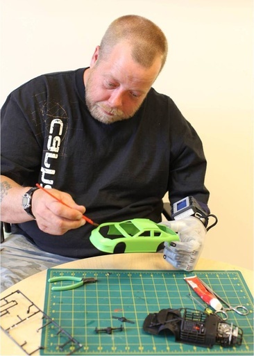 「触覚」が感じられる義手を開発、米国防総省