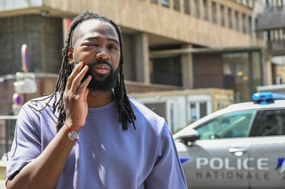 警察拘束下で死亡した男性の弟、追悼デモで拘束され負傷 仏