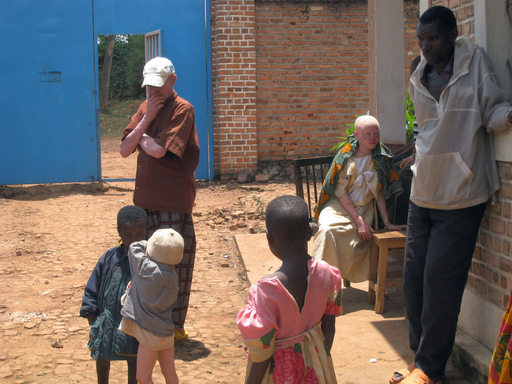 呪術師に高値で売れる 東アフリカ ブルンジのアルビノに魔の手 写真6枚 国際ニュース Afpbb News