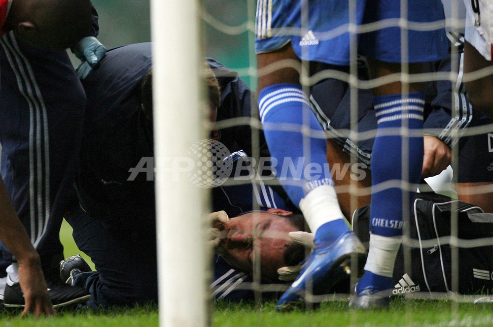 サッカー カーリング杯＞負傷の記憶がないジョン・テリー - 英国 写真1