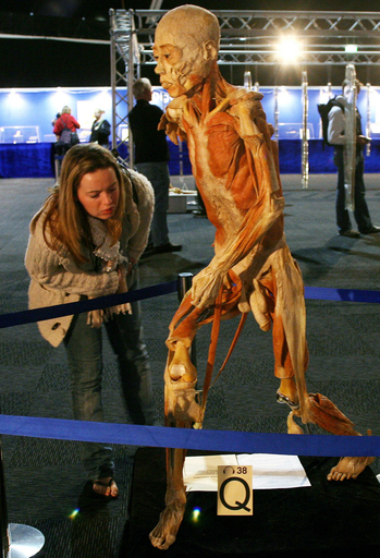 メルボルンで実物の人体標本展