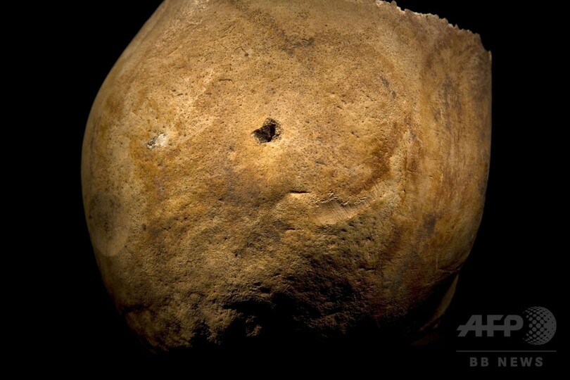 リチャード3世の「凄惨な死」、遺骨から明らかに