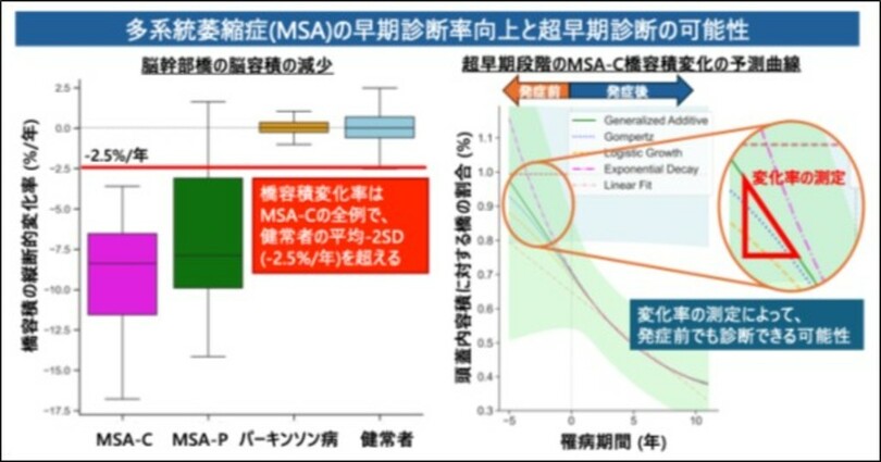 多系統萎縮症小脳型の早期診断や症状の進行指標となりうる画像バイオマーカーを同定