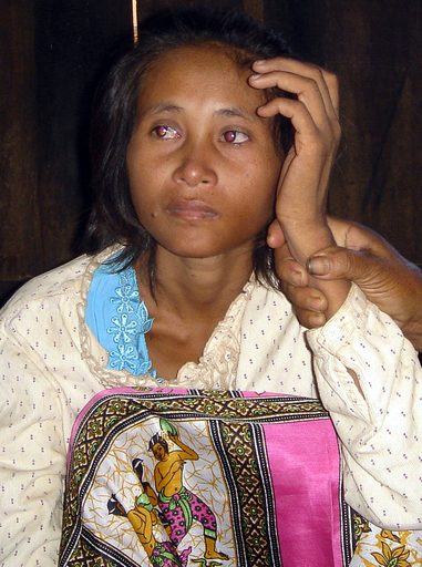 19年ぶりに発見された女性の父親、DNA鑑定を希望 - カンボジア