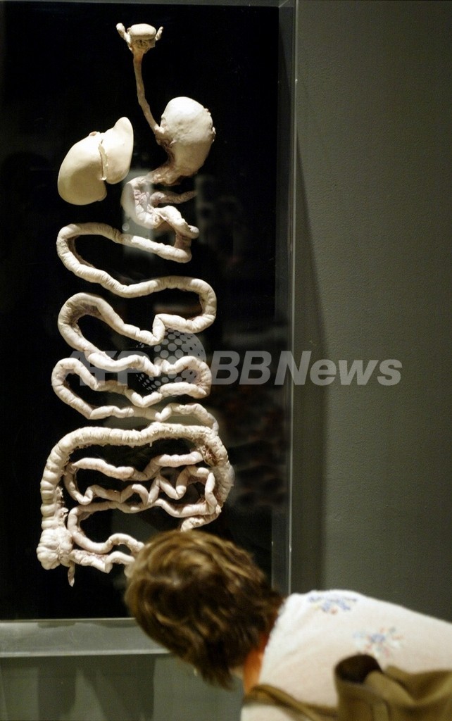 ｢泳ぐ内視鏡｣で撮影に成功、患者負担の軽減に期待 大阪