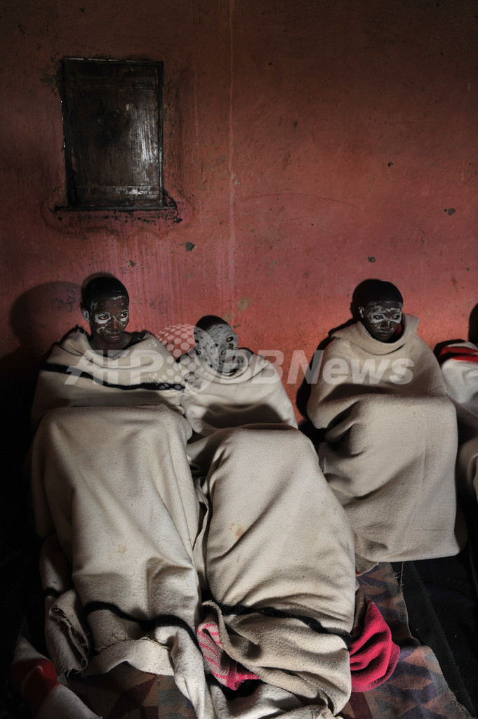 「男」になるための割礼、死亡事故や自殺の原因にも 南アフリカ