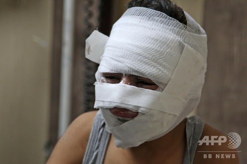 ロシアが停戦発表のシリアで戦闘激化 市民18人死亡の情報