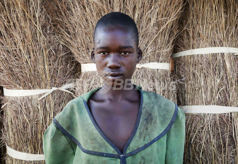 ウガンダの子供たちを襲う謎の奇病「うなずき病」、原因も治療法も不明