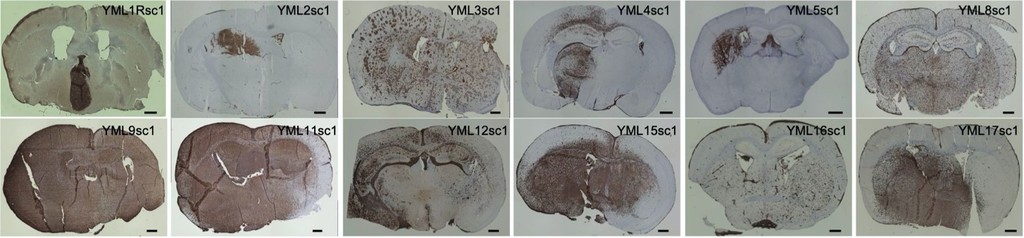 中枢神経原発悪性リンパ腫PCNSLの原因と進行のメカニズムおよび治療標的分子の解明<br /> 中枢神経原発悪性リンパ腫PCNSLの原因と進行のメカニズムおよび治療標的分子の解明<br />