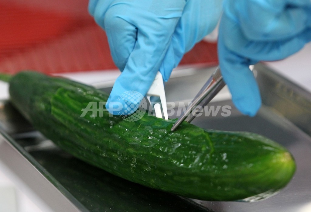 ドイツの病原性大腸菌による死者14人に ドイツの病原性大腸菌による死者14人に