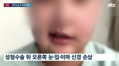 ソウル有名整形外科で顔の輪郭手術、そして「鼻・口から黒い血」「顔面まひ」…職失った20代韓国女性