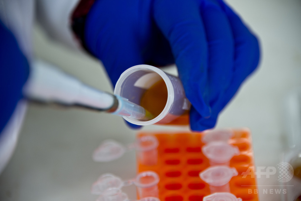生物医科学論文の大半に不備、信頼性に疑問符 生物医科学論文の大半に不備、信頼性に疑問符