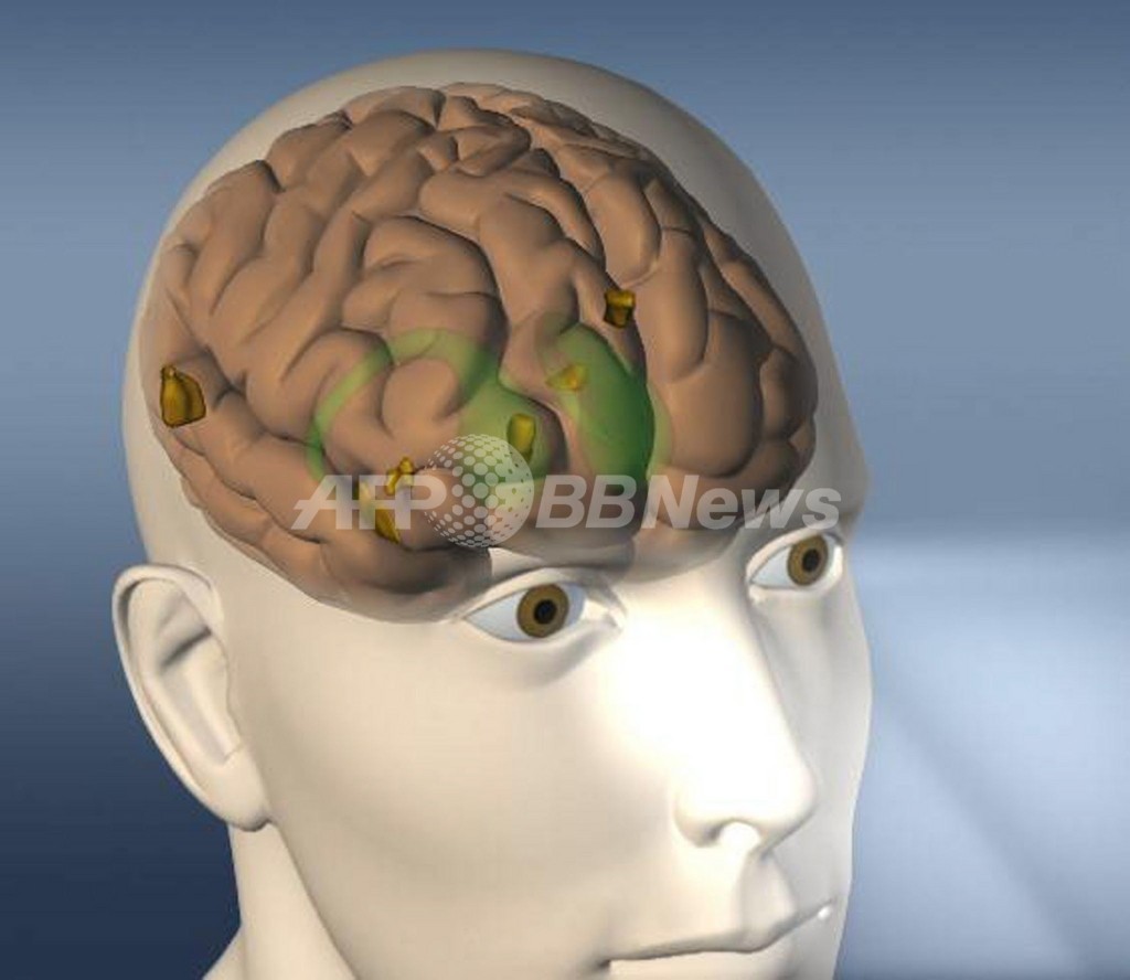 脳の動きで見ているものを当てる、脳解析で劇的な進歩 米研究報告 脳の動きで見ているものを当てる、脳解析で劇的な進歩 米研究報告