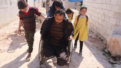 動画：両脚両目も失った…体に刻まれる「紛争の地図」 シリア内戦10年目