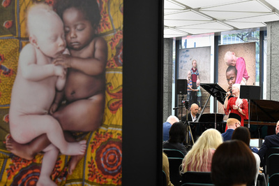 世界で起きている「アルビニズム」への迫害知って 東京で啓発イベント