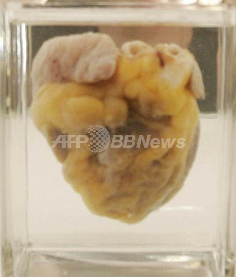幹細胞使わず心臓組織を再生 動物実験で効果 米研究
