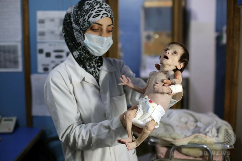 夕食はお湯だけ 飢餓に苦しむシリア封鎖地域