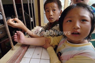 知能発育不全の原因となる遺伝子異常を特定、米ワシントン大
