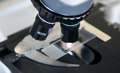 声帯組織の培養に成功、移植も視野に 米研究