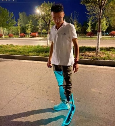 左足を失った中国人男性 リアル「アイアンマン」に