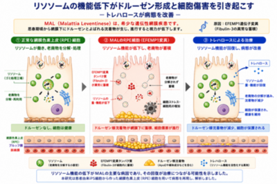 リソソーム異常が希少眼疾患の原因