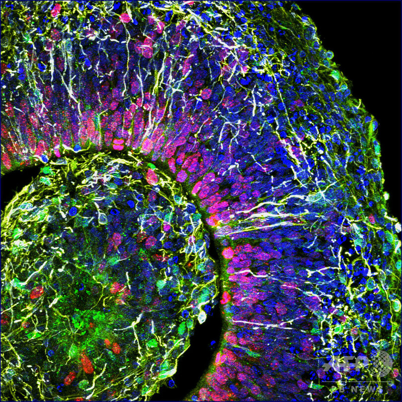 実験室で培養の「ミニ脳」に神経活動、人の脳に類似 米研究