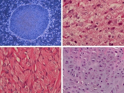 より安全なiPS細胞の作製に成功、英国とカナダの研究チーム