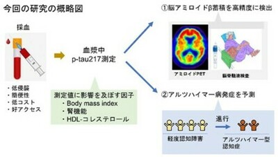 血液バイオマーカー“p-tau217”は脳内病理を高精度に検出し、アルツハイマー病の発症を予測する