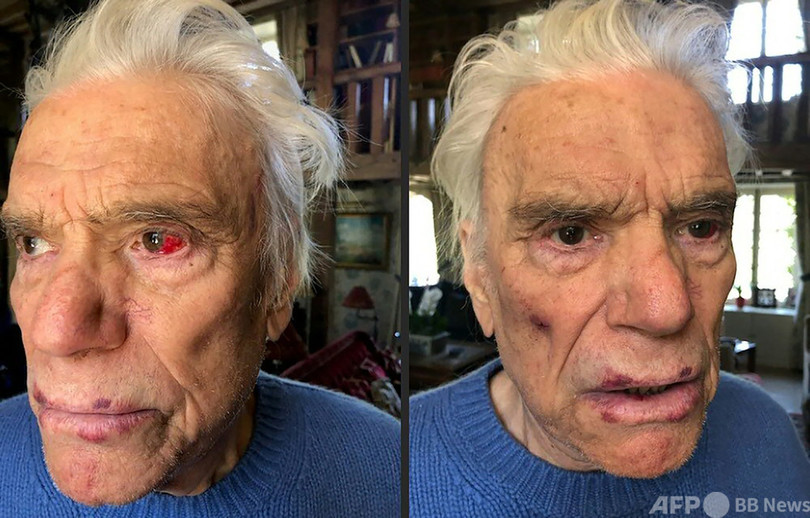 アディダス元オーナーの豪邸に強盗 顔殴打も 仏