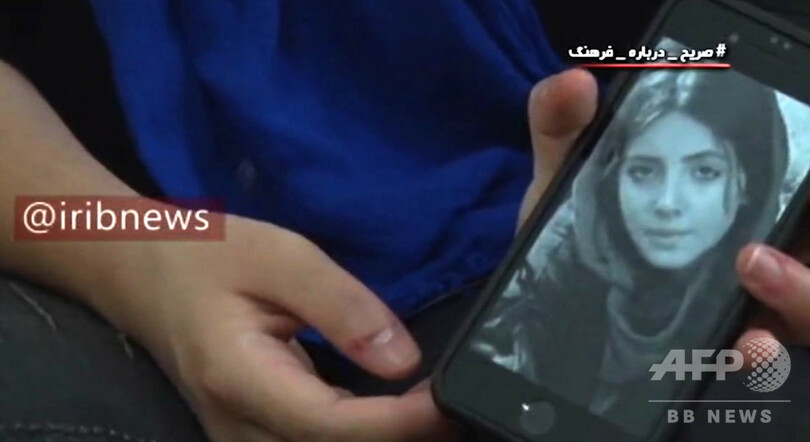 美容整形で「ゾンビ」顔に…有名インスタグラマーが後悔語る イラン