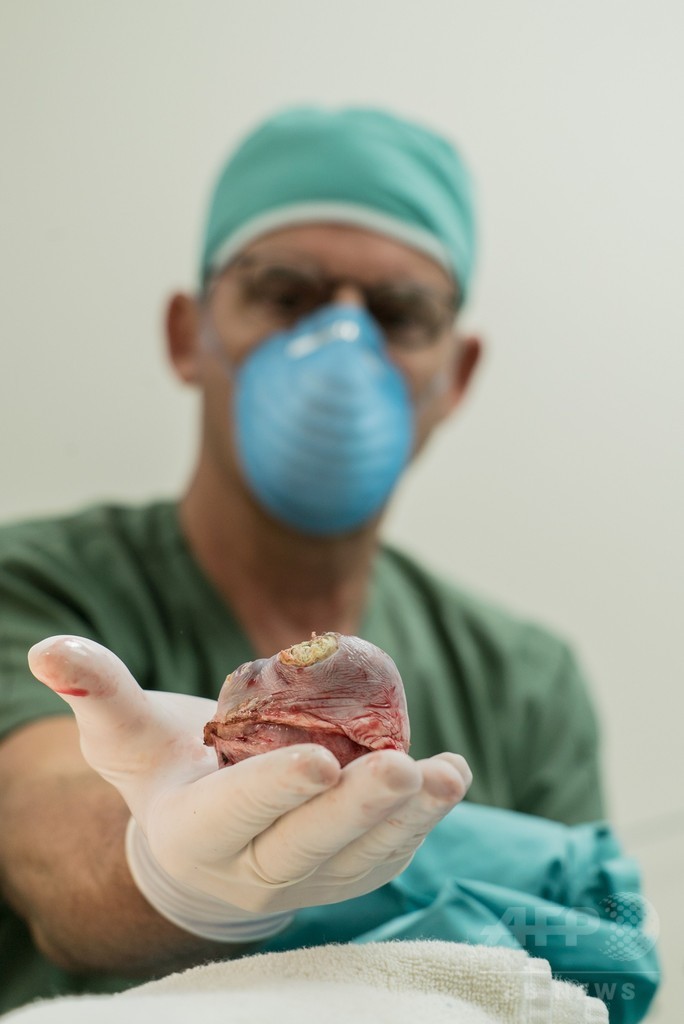 乳頭腫のウミガメ増加、対応に追われる米フロリダの「カメ病院」