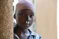 ニジェールのジンデルに設置されたスイスのNGO「サンティネル」の診療所で、壊疽性口内炎（水がん）によって壊疽した顔の部分の再建手術を受けた少女（2015年5月26日撮影）。(c)AFP/ISSOUF SANOGO