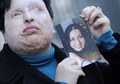男に酸を浴びせられ失明する被害に遭い、事件前の自身の写真を掲げるイラン人のアメネ・バハラミさん（2009年3月5日撮影、資料写真）。(c)AFP/LLUIS GENE