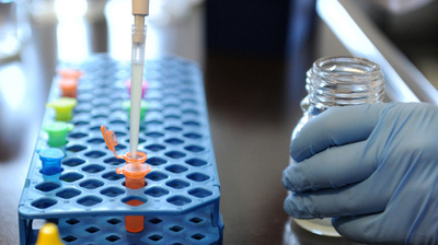 薬剤耐性菌の弱点を特定、強固な外膜の構築阻止へ前進 研究