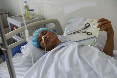 18年前の手術で置き去りのはさみ、体内から摘出 ベトナム