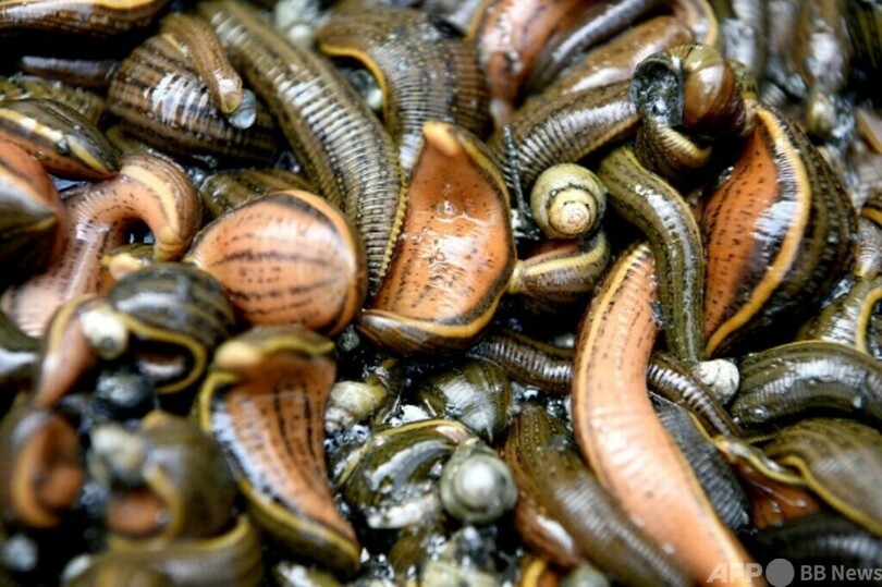 60代女性、半月も咳止まらず検査したら気管に8センチのヒル 中国雲南省