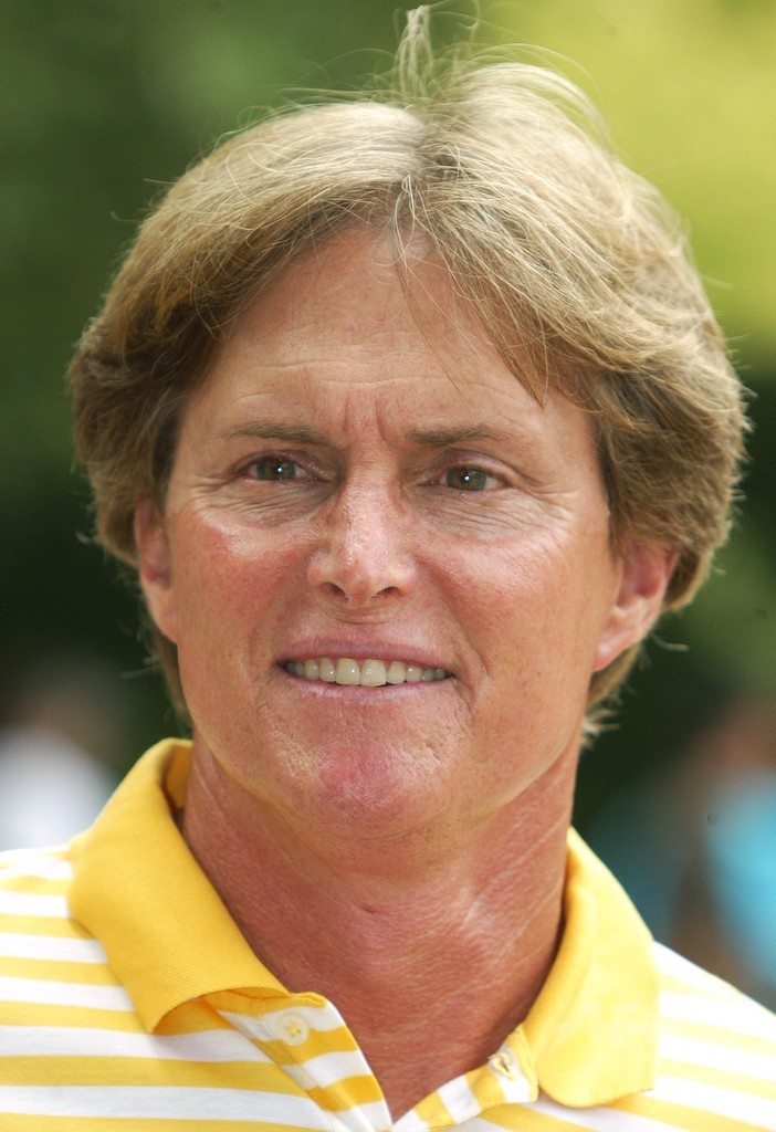 【特集】激変セレブのビフォー＆アフター