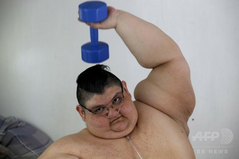 世界で最も重かった男性、250キロ減量 再び歩けることを夢見て