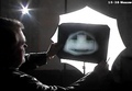 ロシアの国営テレビ局で放映された、通信装置が埋め込まれた石の形をした箱のX線写真を眺める男性（2006年1月23日撮影）。(c)AFP/EURONEWS-ROSSIYA TELEVISION