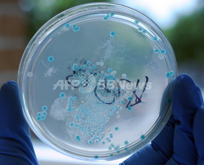 欧州の大腸菌感染で新たな死者、スペイン産キュウリの警告は撤回 欧州の大腸菌感染で新たな死者、スペイン産キュウリの警告は撤回