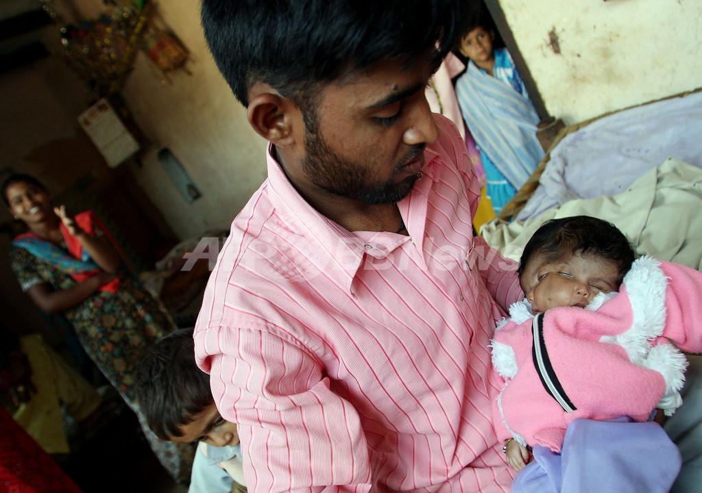 インドで顔が2つある赤ちゃん誕生 神の化身 国際ニュース Afpbb News